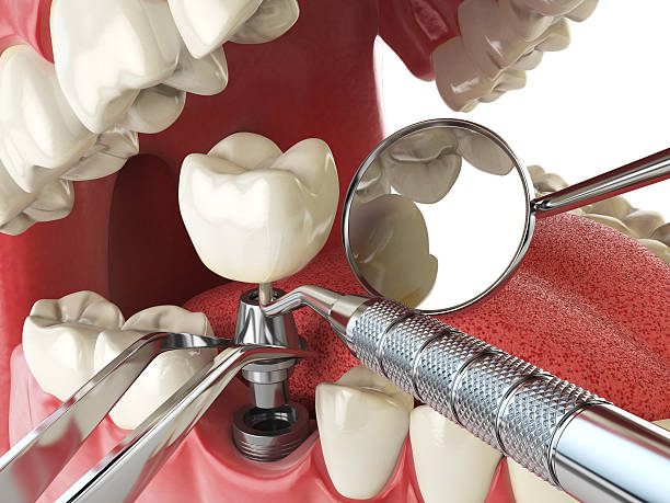 Best Weekend Emergency Dentist in Barbourville, KY
